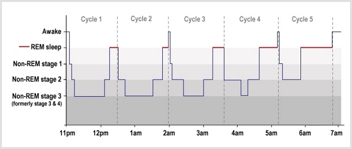 Sleep Cycles Hypnogram by Luke Mastin